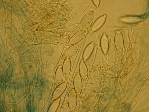 macrostoma