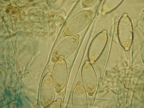 macrostoma
