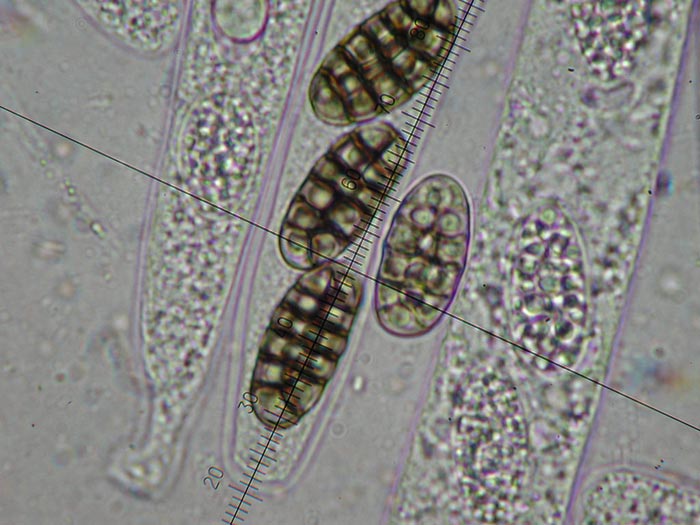 macrostoma