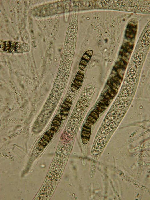 macrostoma