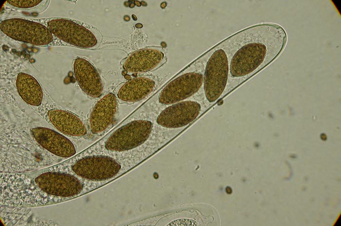 macrostoma