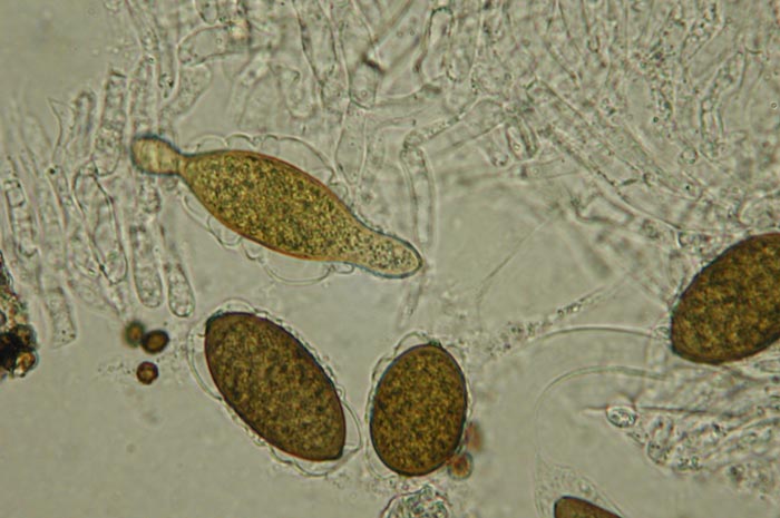 macrostoma