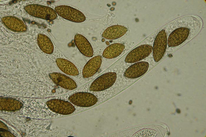 macrostoma