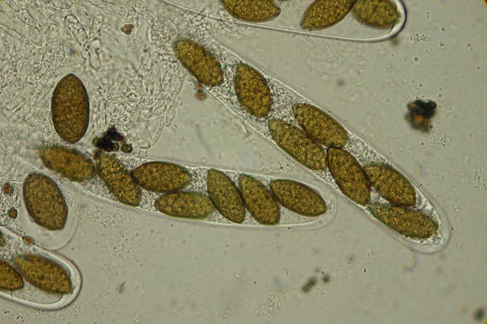 macrostoma