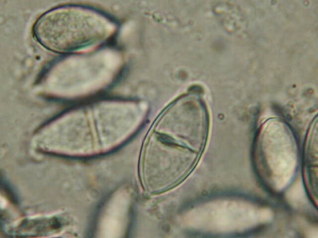 macrostoma