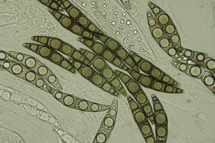 macrostoma