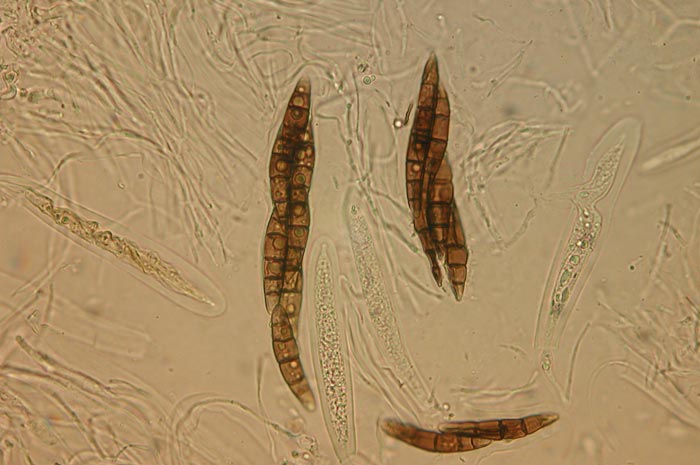 macrostoma