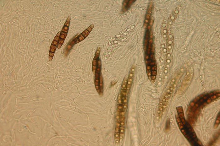 macrostoma
