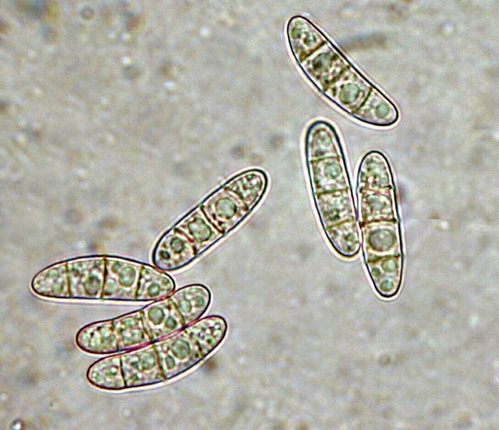 macrostoma