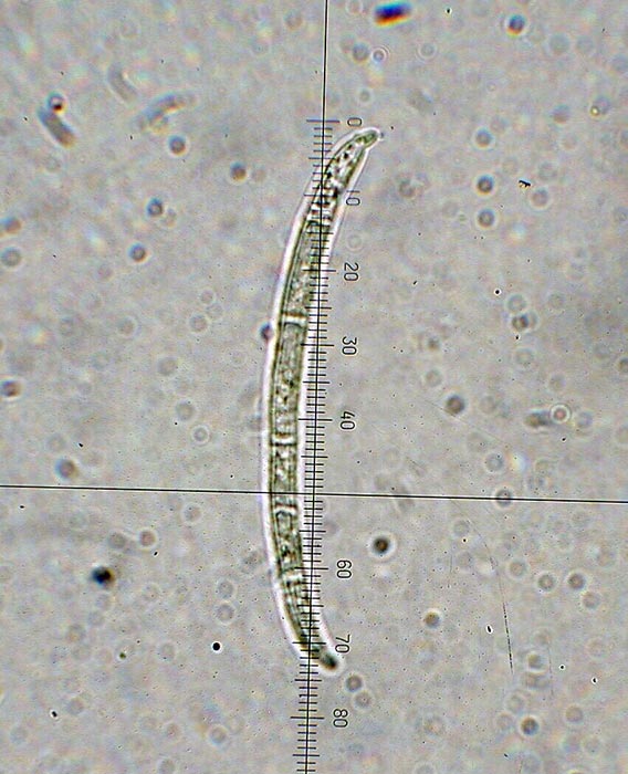 macrostoma