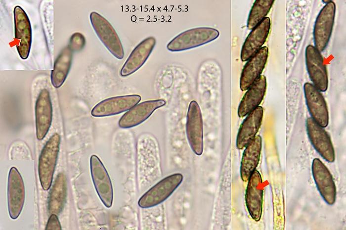 macrostoma