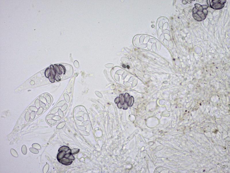 macrostoma