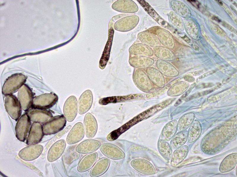 macrostoma