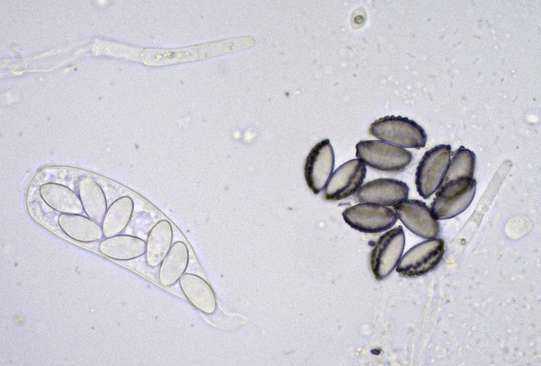 macrostoma