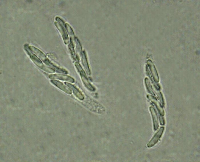 macrostoma