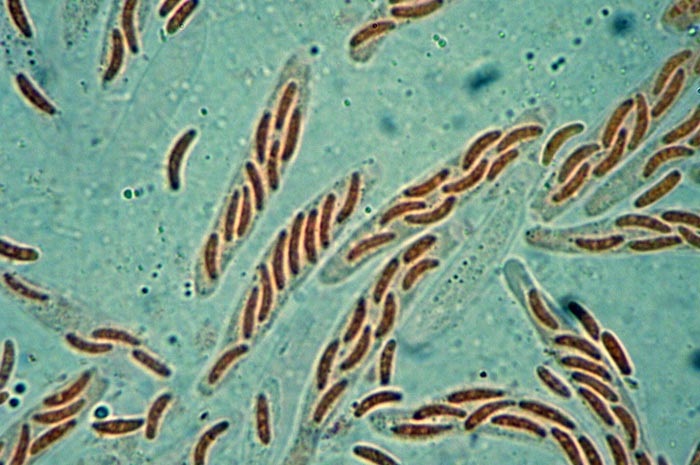 macrostoma