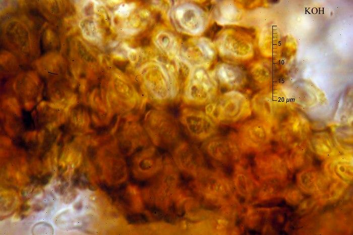 macrostoma
