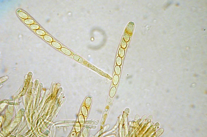 macrostoma