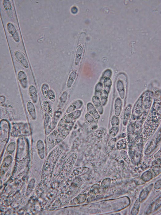 macrostoma