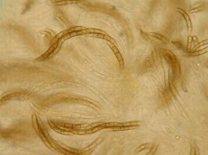 macrostoma