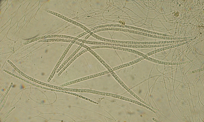 macrostoma