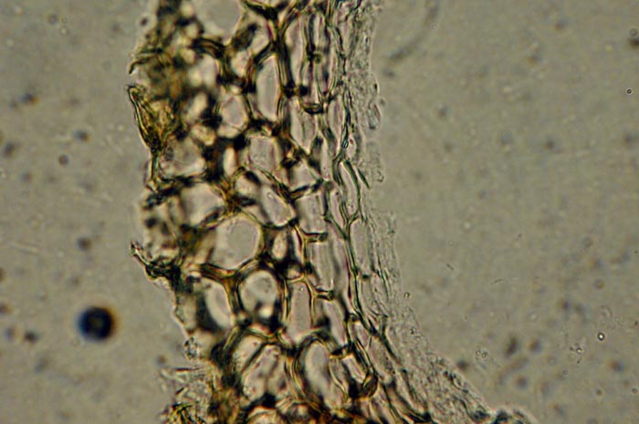 macrostoma