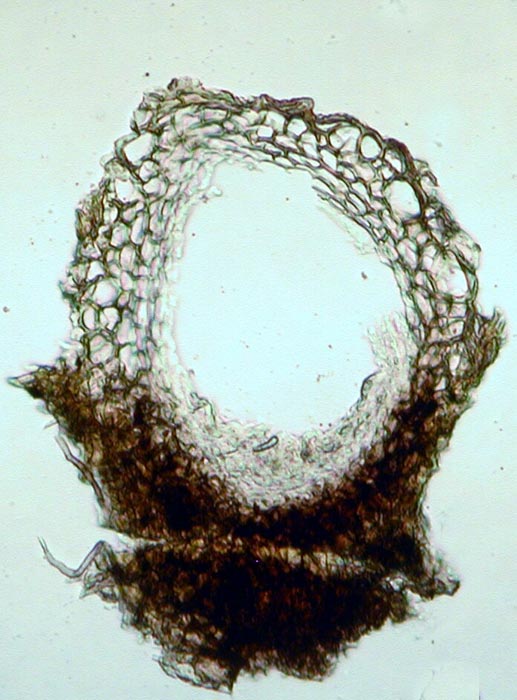 macrostoma