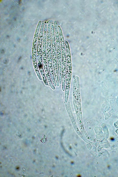 macrostoma