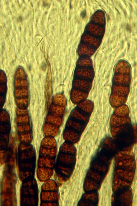 macrostoma