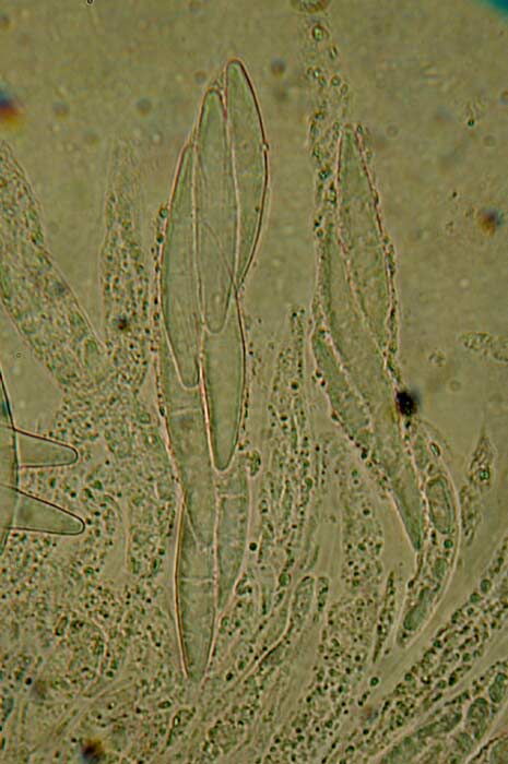 macrostoma