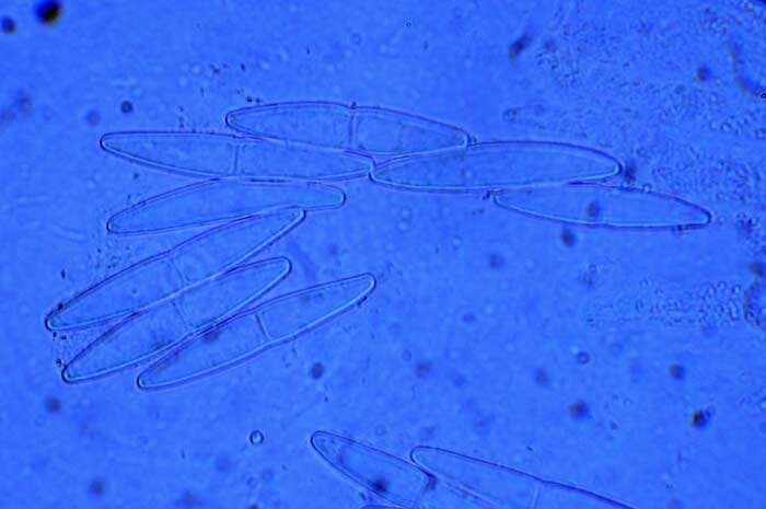 macrostoma