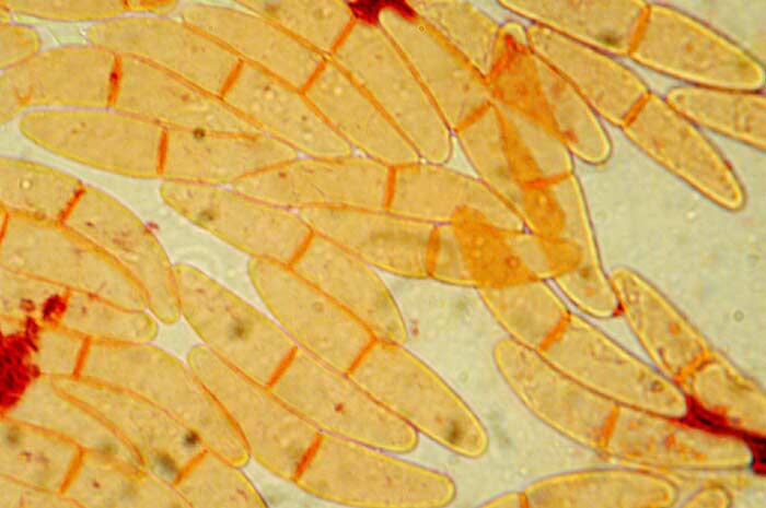 macrostoma