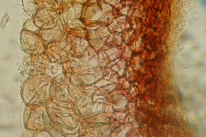 macrostoma