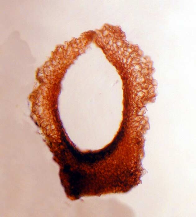 macrostoma