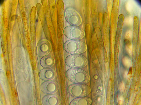 macrostoma