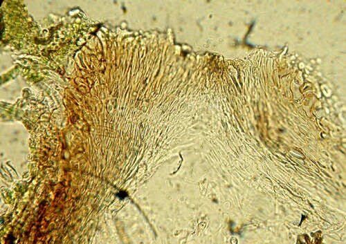 macrostoma