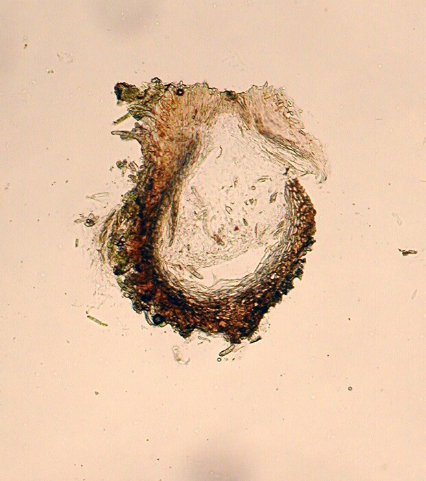 macrostoma
