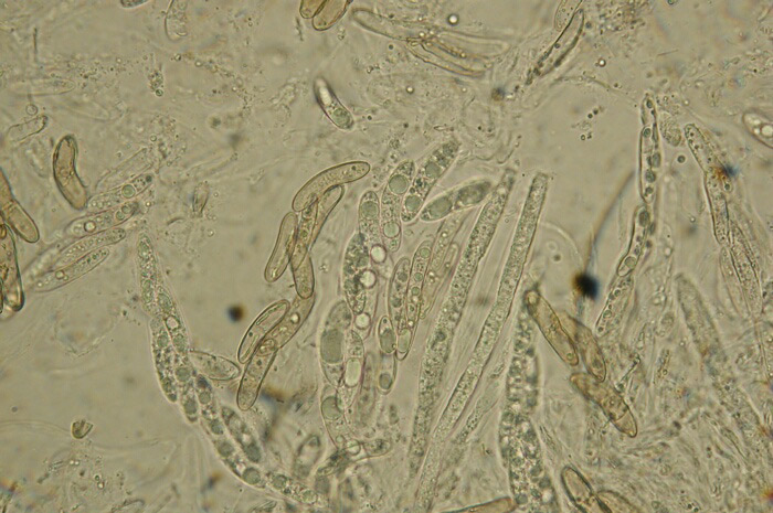 macrostoma