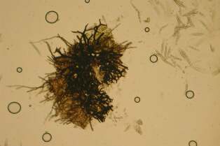 macrostoma