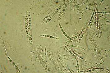 macrostoma
