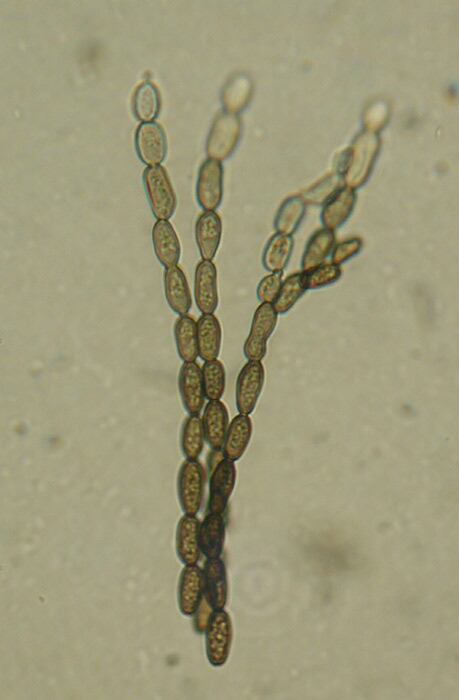 macrostoma