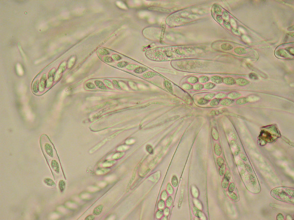 macrostoma