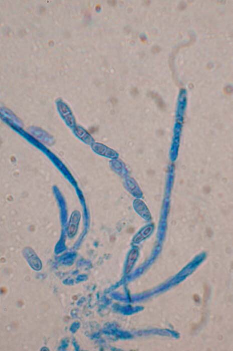 macrostoma
