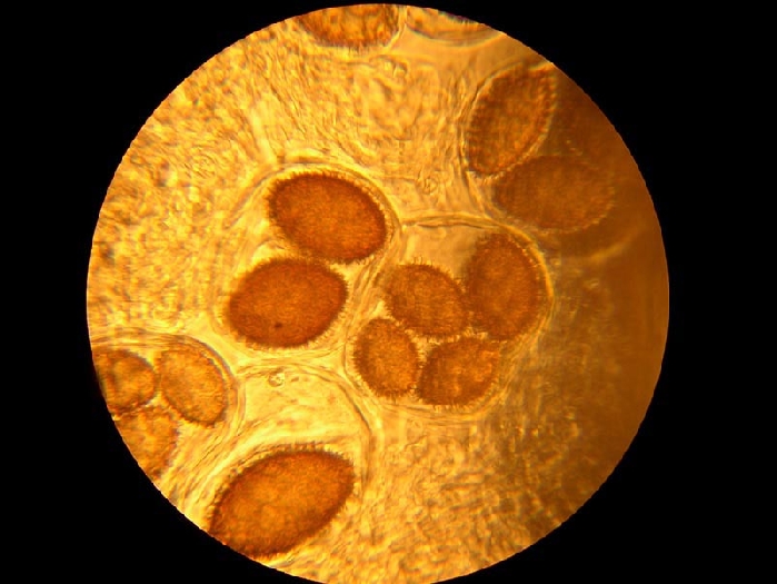 macrostoma