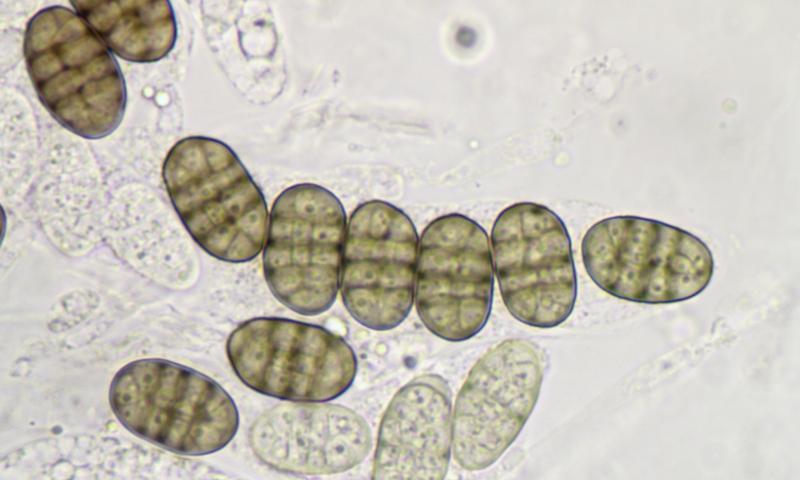 macrostoma