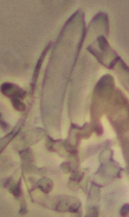 macrostoma