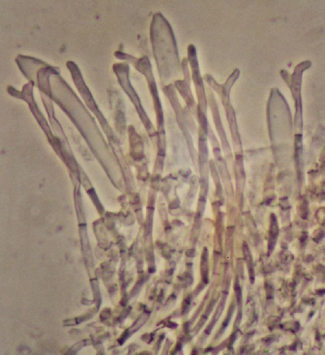 macrostoma