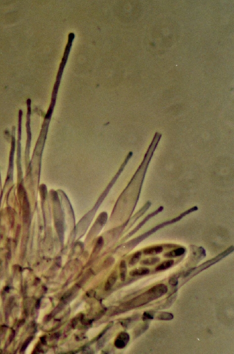 macrostoma