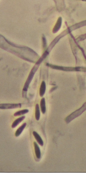 macrostoma