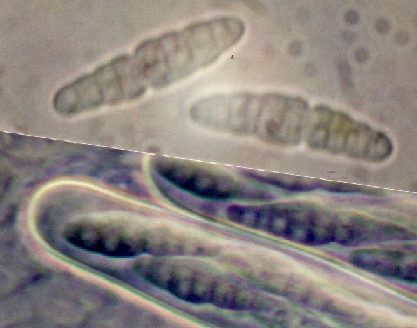 macrostoma